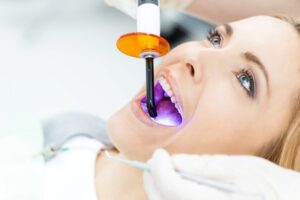 Best Cosmetic Dentistry in Gurgaon, Dentaire Smile 